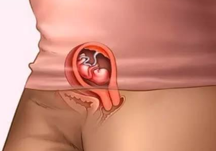  保定49岁助孕龙凤胎：怀孕第10周胎儿稳定吗,胎儿在第10周